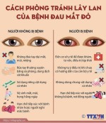 ĐAU MẮT ĐỎ VÀ CÁCH PHÒNG TRÁNH